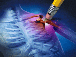 chronic-pain in workers compensation